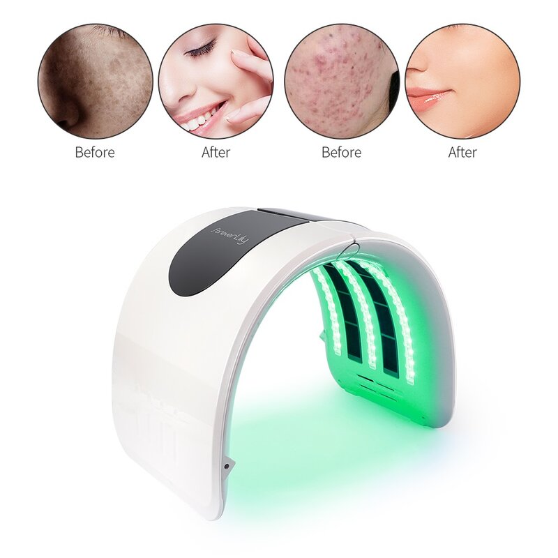 Terapia fotonica a LED 7 colori PDT ringiovanimento della pelle del viso macchina rimozione dell'acne trattamento antirughe e riscaldamento
