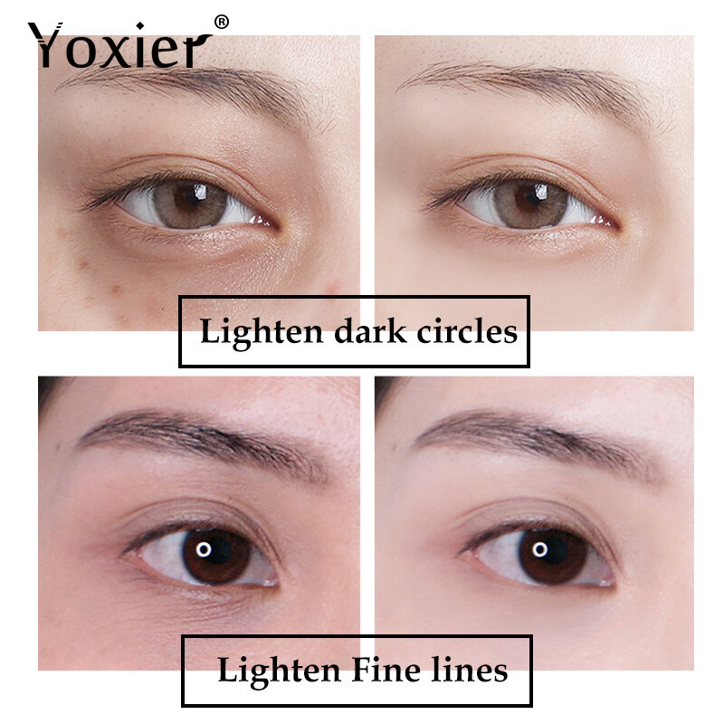 Yoxier Snail Firming Eye Serum Eye Cream Anti-Aging  Anti-Puffiness Fine Lines Dark Circle Moisturizing Skin Care Eye Patches