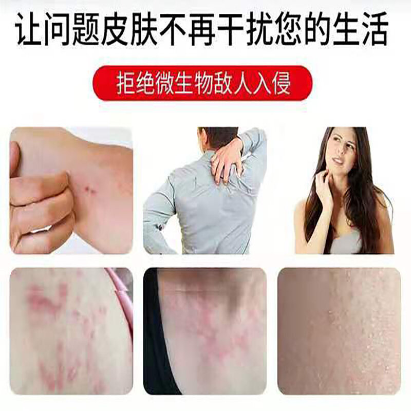 Gaitianling Pikangwang chińskie zioła krem antybakteryjny skóra antybakteryjny krem przeciwświądowy 1pc