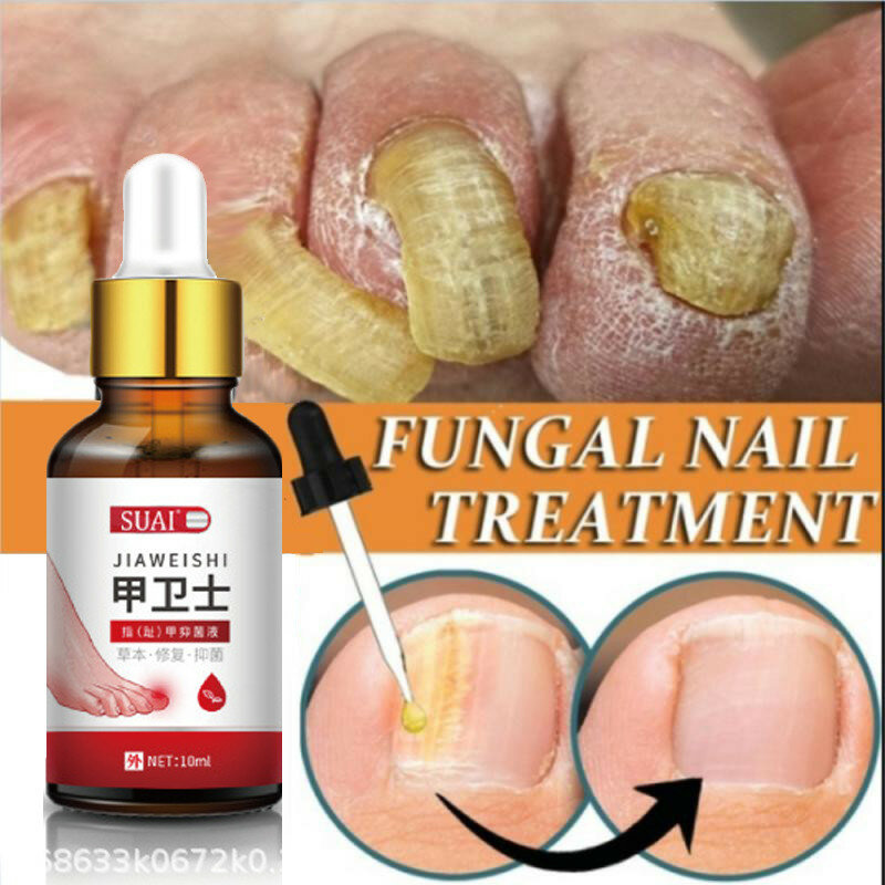 Anti Fungus Nail Treatment Essense Anti Infection Paronychia Toe Nails Fungal Repair Serum Onychomycosis Remover Hand Foot Care