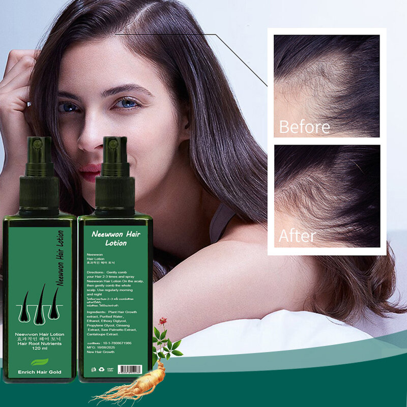 NEO Enrich neewwon marca loção de crescimento do cabelo produtos de cuidados capilares raiz nutrientes anti-perda rebrota tailândia receita
