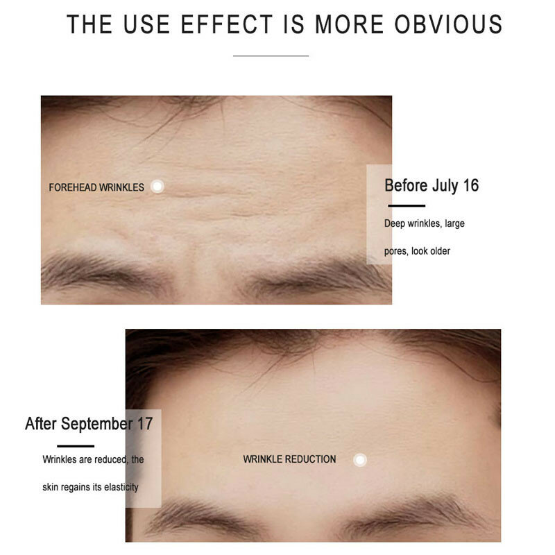 หน้าผากเส้น Removal Patch เจลต่อต้านริ้วรอยหน้าผาก Firming Mask เส้นขมวด Treatment สติกเกอร์ Anti-Aging Lifting Skin Care