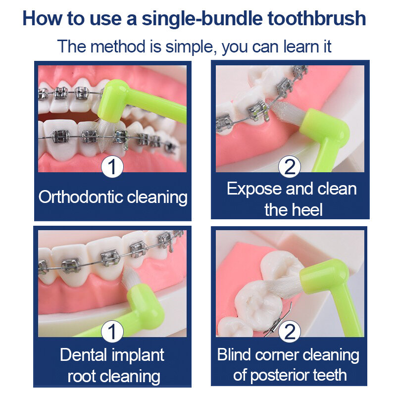 Fawnmum-cepillo de silicona para ortodoncia, herramientas de limpieza Dental, cepillo Interdental para el cuidado de la higiene bucal, 5 piezas