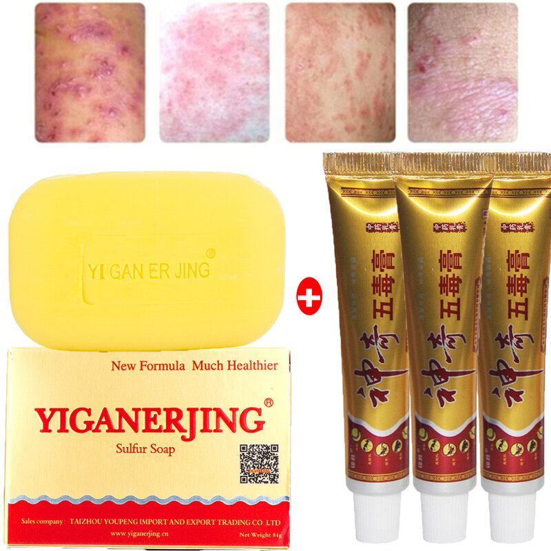 Creme da psoríase de 3 pces, 1 psoríase yiganerjing sabão de enxofre cuidados com a pele tratamento da dermatite eczema limpo profundamente sem caixa 15g