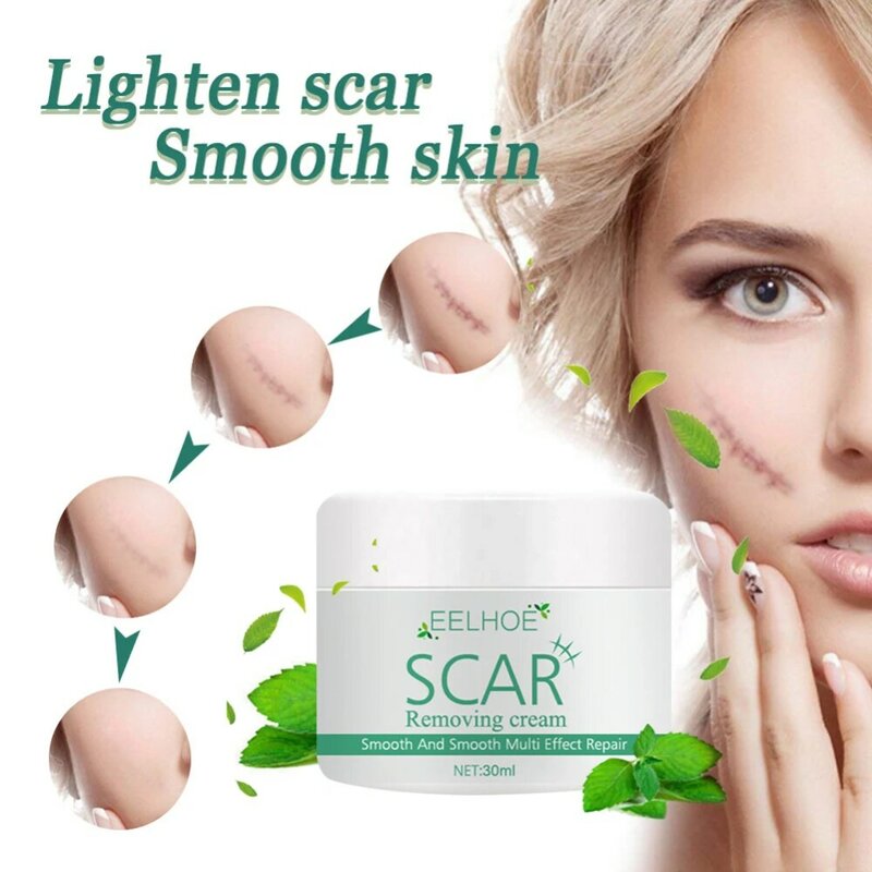 30g Plant Scar Repair Cream Acne Stretch Mark Removal Cream For Burn Scars Old Postoperative Removal Skin Smoothing