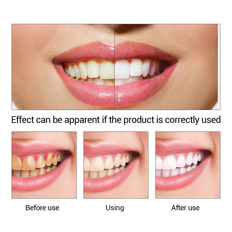 Breylee sbiancamento dei denti siero Gel igiene orale dentale efficace rimuovere le macchie placca denti pulizia essenza cura dentale dente