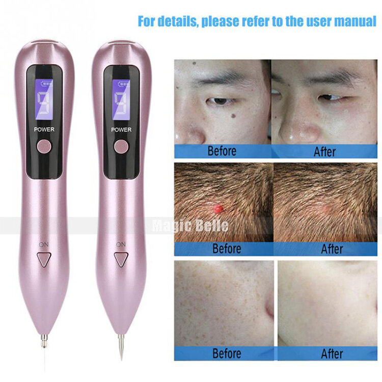 Good LCD Face Skin Dark Spot Remover Mole Tattoo Removal Laser Plasma Pen Machine Facial Freckle Tag Wart Removal Skin Care
