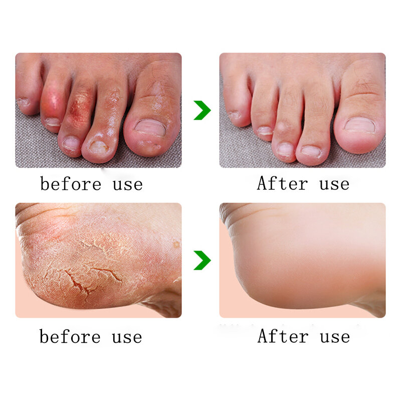 Crème anti-gerçures pour les mains et les pieds, puissante pour l'épluchage du talon, réparation des pieds et des mains, traitement des rides et des gerçures de la peau