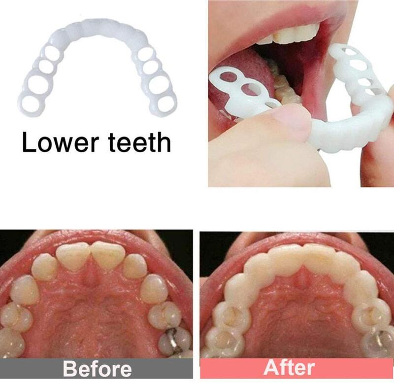 Quente perfeito sorriso dentes falso capa de dente dentes falsos folheados dentes brancos whitenin dentes snap coverdents cosméticos dentadura cuidados