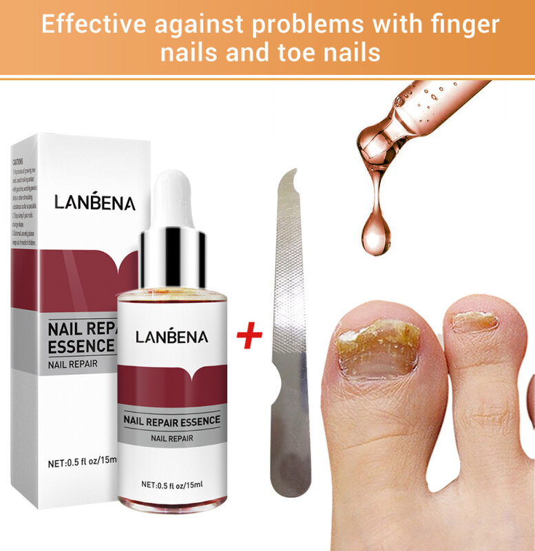 Lanbena reparação de unhas essência soro anti fúngico tratamento de unhas remover onychomycosis nutrir iluminar mão pé toes cuidados com as unhas