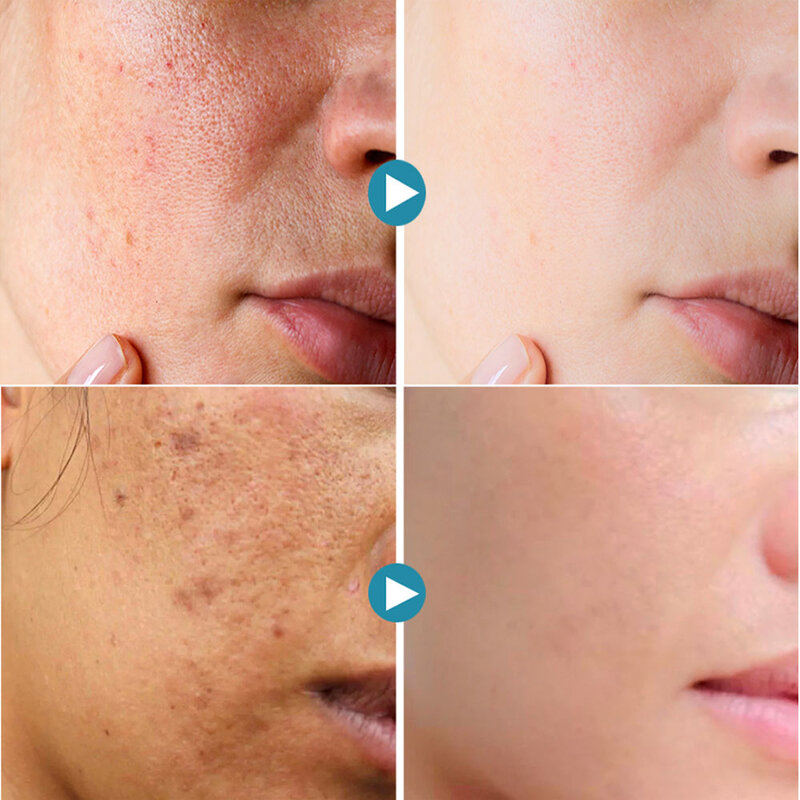 Lactobionic Säure Schrumpfen Poren Serum Koreanische Kosmetik Verblassen Feine Linien Anti-Aging Gesicht Pflege Bleichen Feuchtigkeitsspendende Hautpflege Produkte