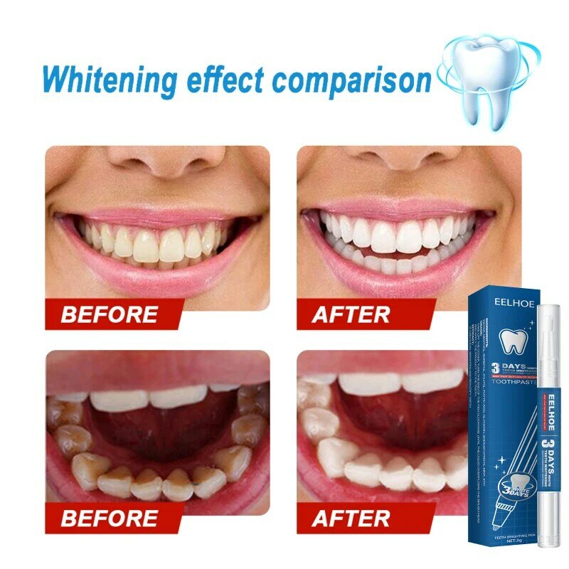 Tooth Whitening Pen Magic Natural Teeth Whitening Gel Pen Cleaning Remove Stains Dental Plaque Tools Tooth Oral Hygiene Care 3ml