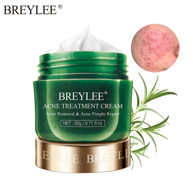 Breylee Acne Treatment Cream Tea Tree Puistje Acne Verwijdering Anti Ontsteking Vervagen Acne Litteken Anti-Acne Kalmeren Acne Crème huidverzorging
