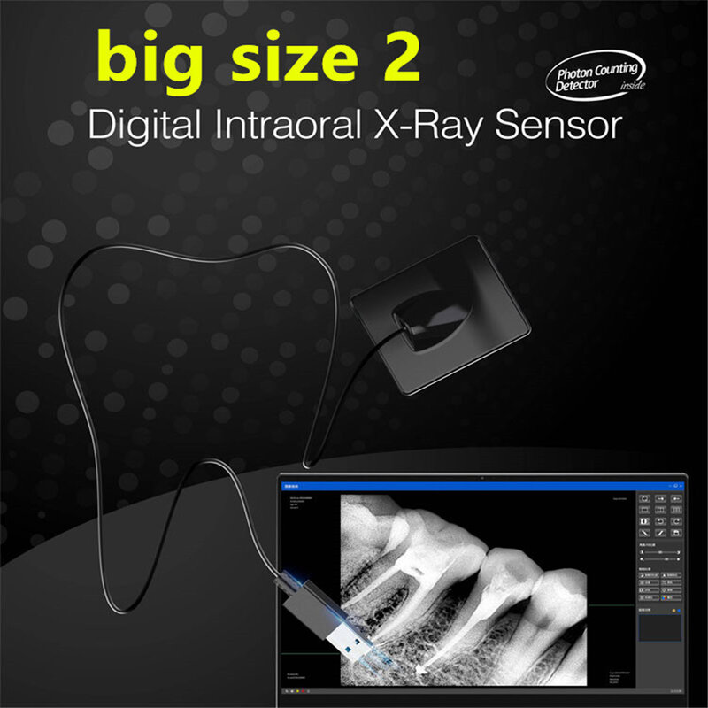 Capteur numérique de rayon X intra-oral, USB, Image RVG, capteur de rayon X, Mslfp12, offre spéciale