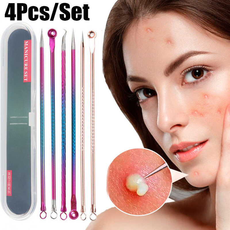4pcs/set Blackhead Acne Remover Tool Acne Extractor Skin Care Tools Stainless Steel  Pimples Acne Blemish Removal Tools