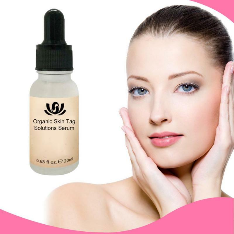 Organic Tags Solutions Painless Serum Mole Skin Dark Spot Remover Facial Serum Wart Tag Freckle Removal Cream Oil Skin Beauty