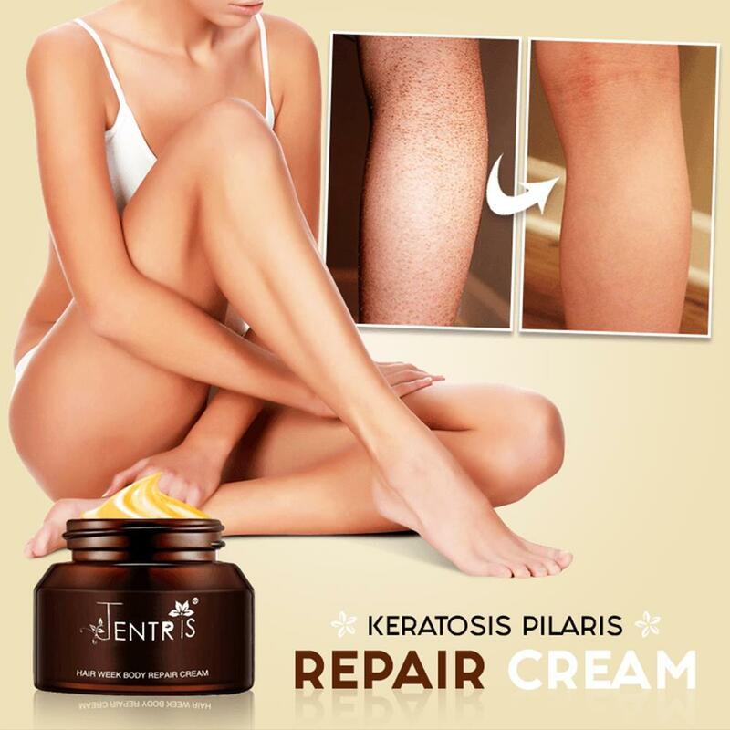 50กรัม/มิลลิลิตร Curing Keratosis Pilaris Kp ไก่ Skin Repair Cream Body โลชั่นบำรุงผิว Essence บำรุง