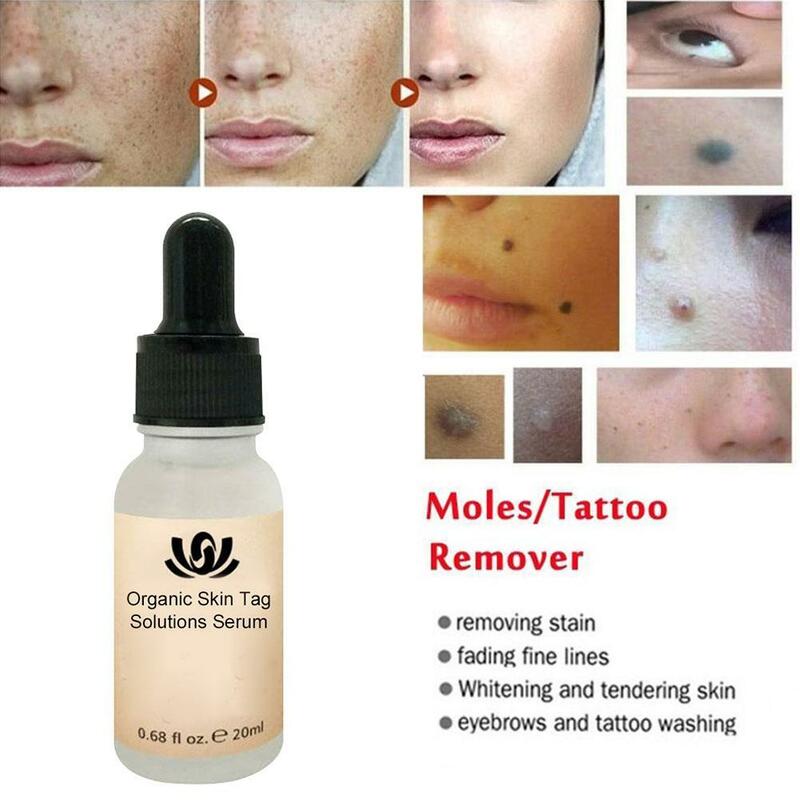 Non-Trace กำจัดตุ่น Potion Blackhead Remover 12ชั่วโมง Medical Fast Repair Skin Tag Mole จุดด่างดำ Face Beauty skin Care เครื่องมือ