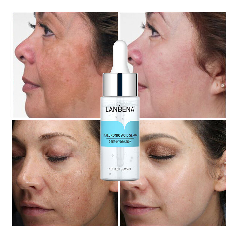 LANBENA Hyaluronic Acid Serum Moisturizing Nourshing Whitening Dull Skin Oil Control Pores Corset Brighten Face Tone Anti-Aging