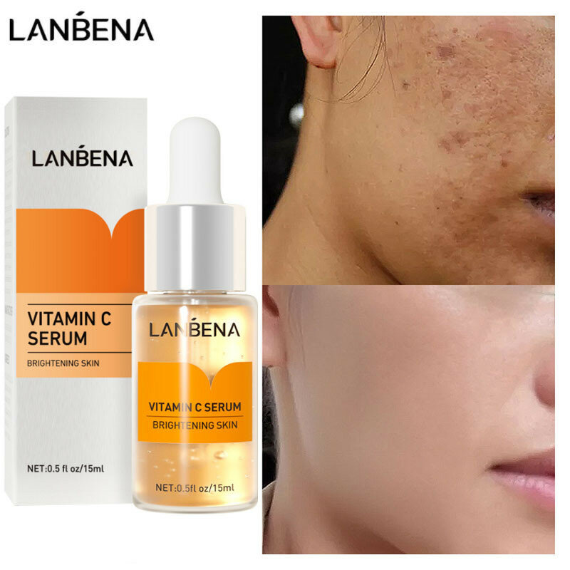 LANBENA Vitamin C Serum Whitening Dark Skin Remove Spot Freckle Melanin Brighten Pigment Dullness Moisturizing Face Care Essence
