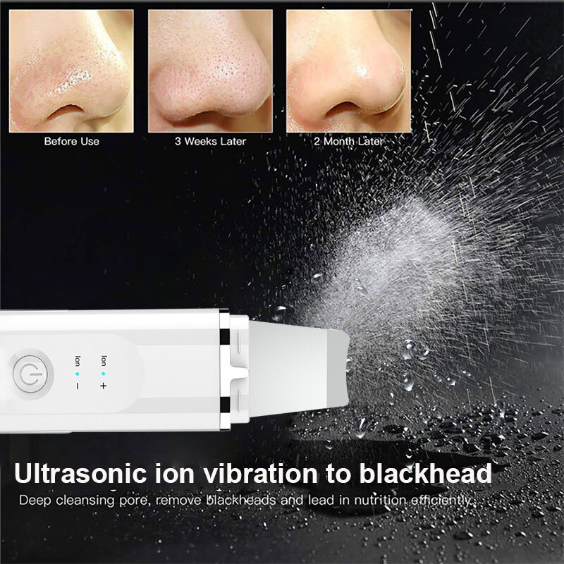 Máquina Eléctrica de limpieza Facial por ultrasonidos, masajeador Facial vibrador, eliminador de espinillas y acné, Lifting Facial