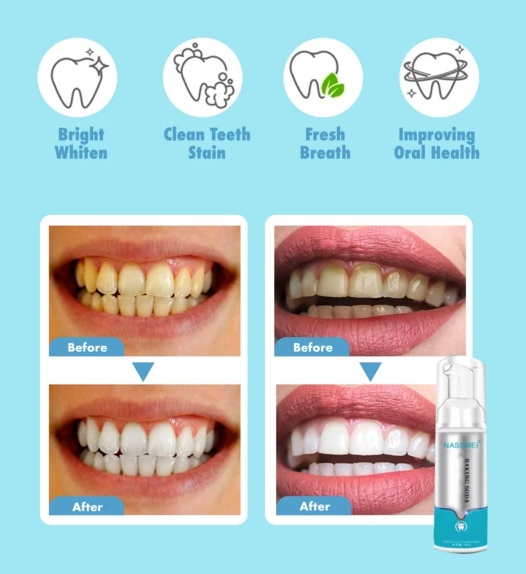 ทำความสะอาดฟันโฟมยาสีฟันไวท์เทนนิ่งฟันถอดสีเหลือง Bad Breath Tartar Brightening ทำความสะอาดโฟมยาสีฟัน