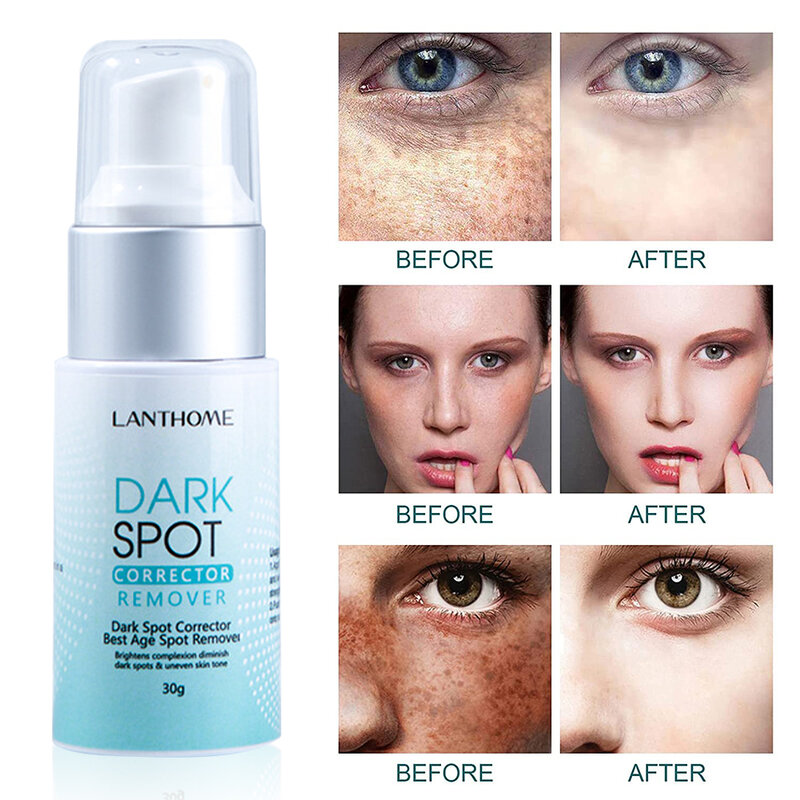 FÜR LANTHOME Dark Spot Remover Corrector Alter Spot Sommersprossen Entfernung Emulsion Bleaching Feuchtigkeits Anti-Aging Reparatur Hautpflege