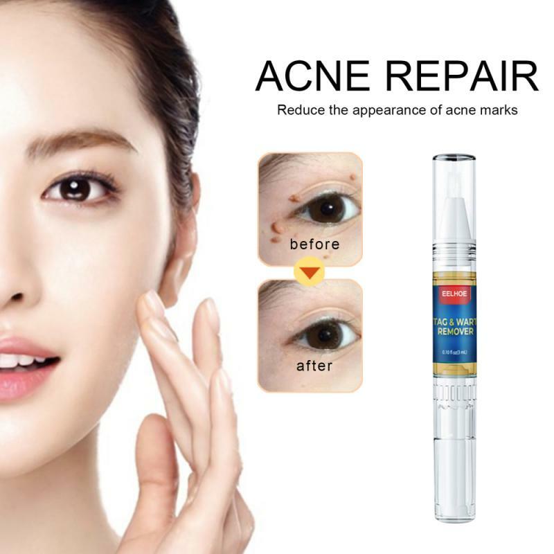 2021 HOT nowy kolor skóry Tag Cure usuwanie ciała Mole brodawki Remover Spot Marks Wart Pen czysta skóra kobiety pielęgnacja twarzy przyrząd kosmetyczny