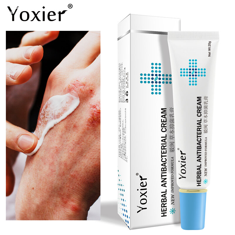 Yoxier-허브 항균 크림, 건선 크림, 가려움증 완화, 습진, 피부 발진, 절개 치료, 드랍쉽