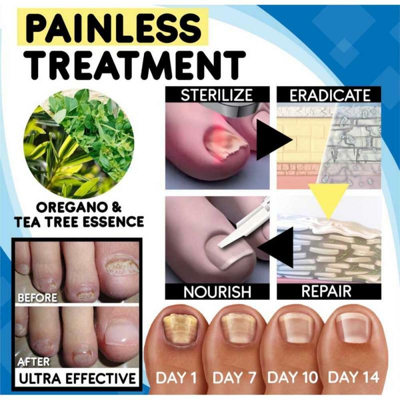 Painless Remedy For Nail Fungus Anti-fungal Home Treatment Set Onychomycosis Paronychia Anti Fungal Fungus Care Repair TSLM1 K
