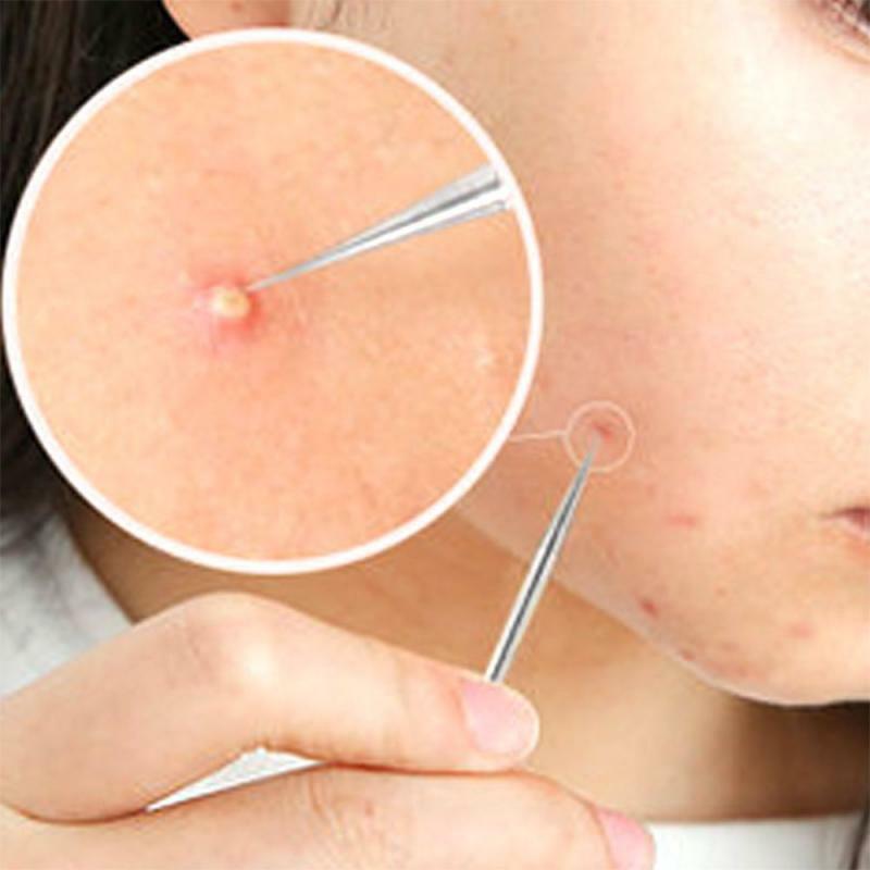 4 pçs/set Ferramenta Removedor de Cravo Blemish Pimple Acne Aço Inoxidável Agulha Remoção Rosto Cuidados Com A Pele Beleza Facial Pore Cleaner