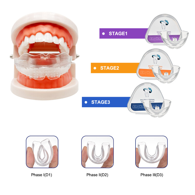 Erwachsene Dental Kieferorthopädie Hosenträger Zähne Haarglätter Bleaching Halterungen Zahn Ausrichtung Corrector Tool Zähne Schleifen Wachen