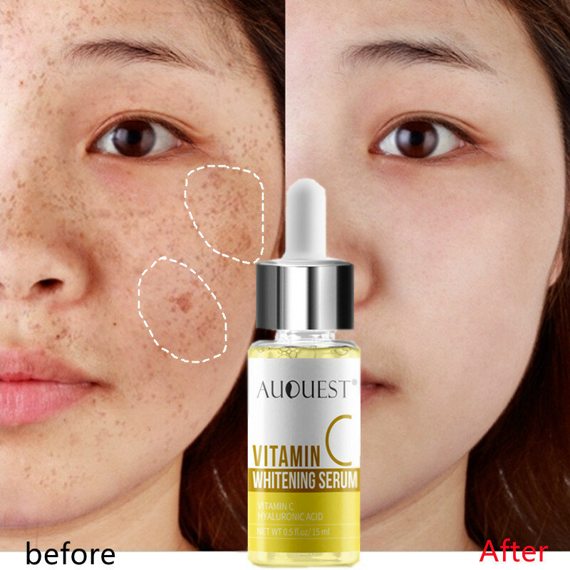 Vitamina c clareamento rosto soro clarear manchas escuras clareamento remover sarda manchas acne cicatrizes esence reparação cuidados com a pele produtos