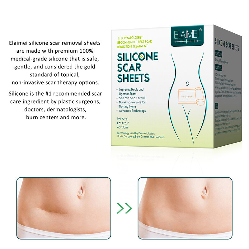 4x300cm Efficient Surgery Scar Removal Silicone Gel Sheet Therapy Patch for Acne Trauma Burn Scar Skin Repair Scar Treatment