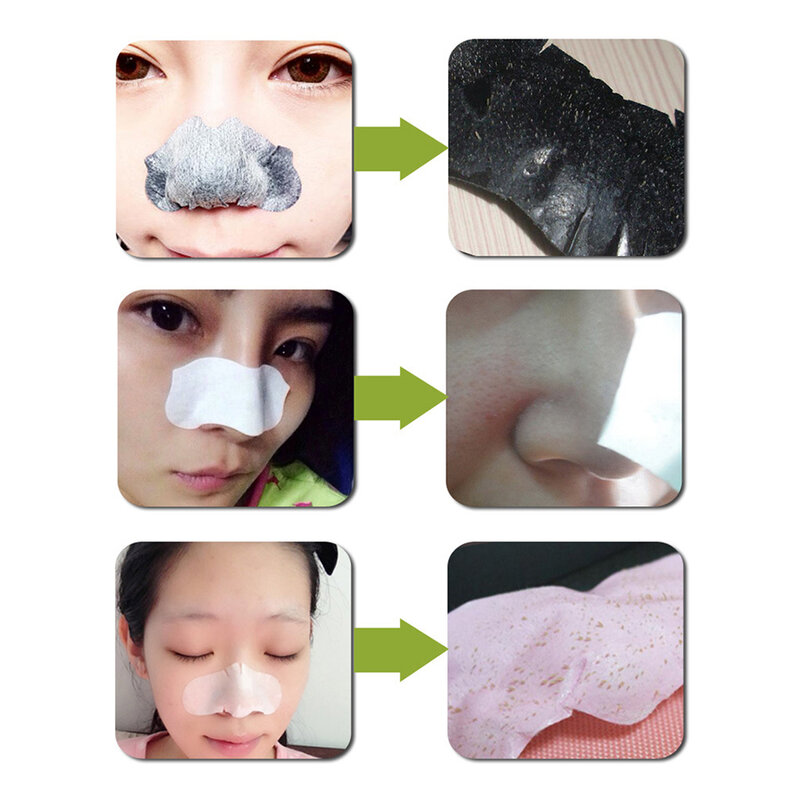 5pc Bambus Holzkohle Mitesser Entferner Schwarze Punkte Flecken Akne Behandlung Nase Aufkleber Reiniger Nase Poren Tiefe Sauber Streifen