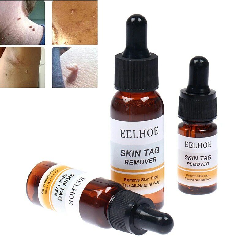 10/20/30ml Skin Tag Remover Mole Foot Corn Wart Care Treatment   Pure Acid Essence 100% Essence Hyaluronic Serum Natural Oil