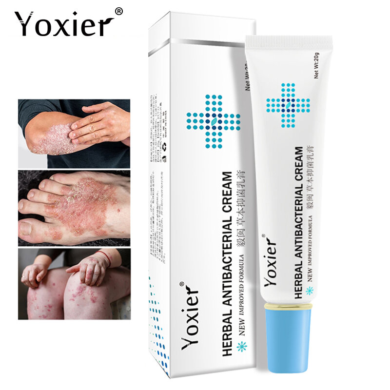 Yoxier creme antibacteriano erval psoríase creme anti-coceira alívio eczema pele erupção urticária descamação tratamento 20g