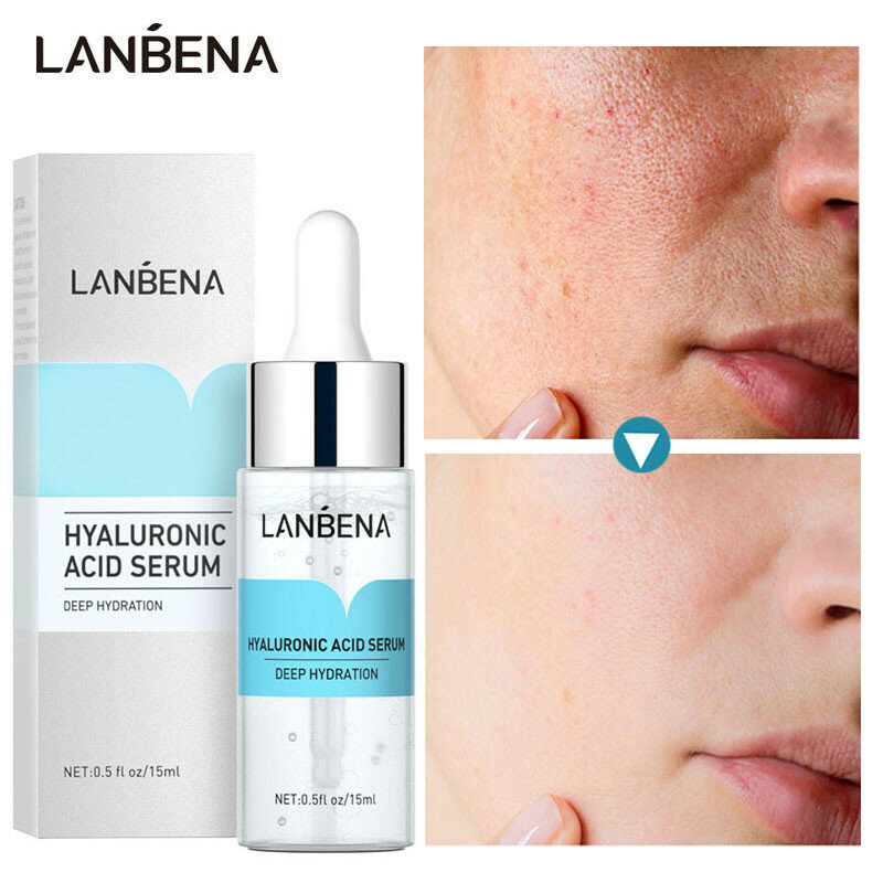 LANBENA – sérum à l'acide hyaluronique, hydratant, nourrissant, blanchissant, peau terne, contrôle des Pores, Corset éclaircissant, tonifiant, Anti-âge