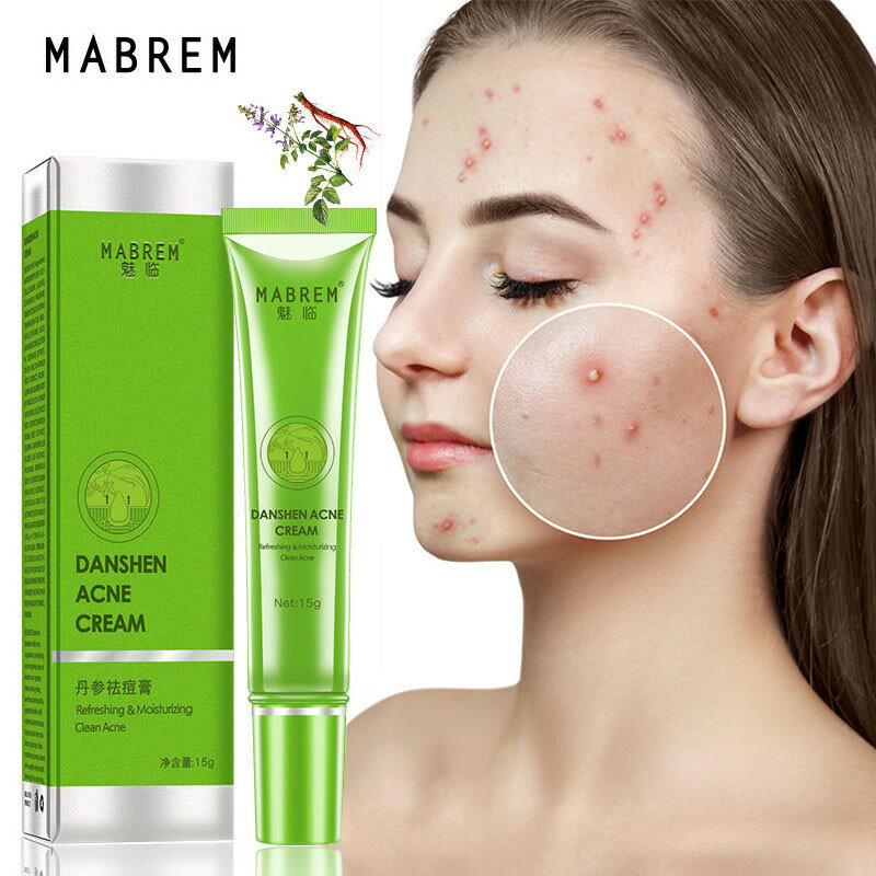 Danshen creme de remoção da acne anti tratamento da acne desvanece-se manchas escuras espinhas controle de óleo poros limpos hidratante clareamento cuidados com a pele