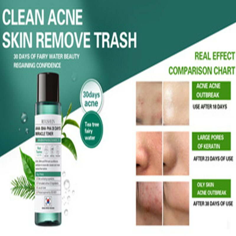 Roushun Miracle Serum Tea Essence Toner 120ml Face Serum Acne Treatment  Scar Blackhead Remover Facial skin whitening lotion