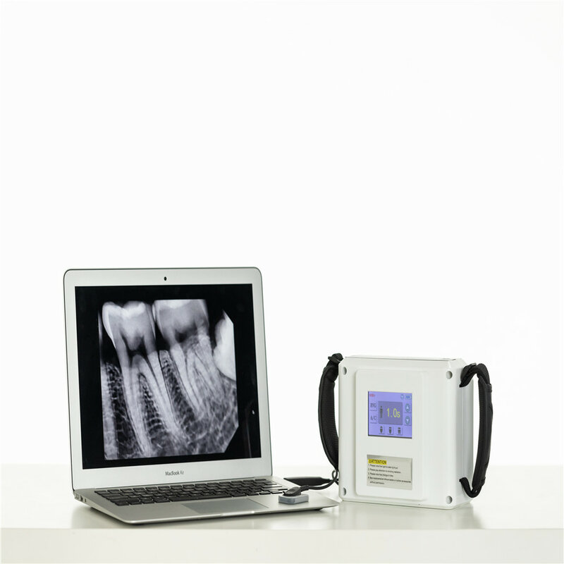Equipo de máquina de rayos x, sensor digital dental, hdr 500 rvg, con pantalla táctil LCD