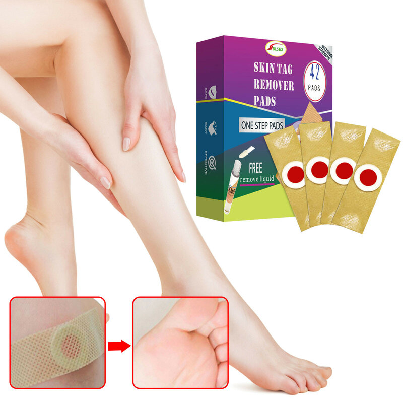 42 Pads Foot Corn Stickers Herbal Medicine Wart Remover Remover Calluses Plantar Warts Skin Care Easy To Use Removal And Lotion