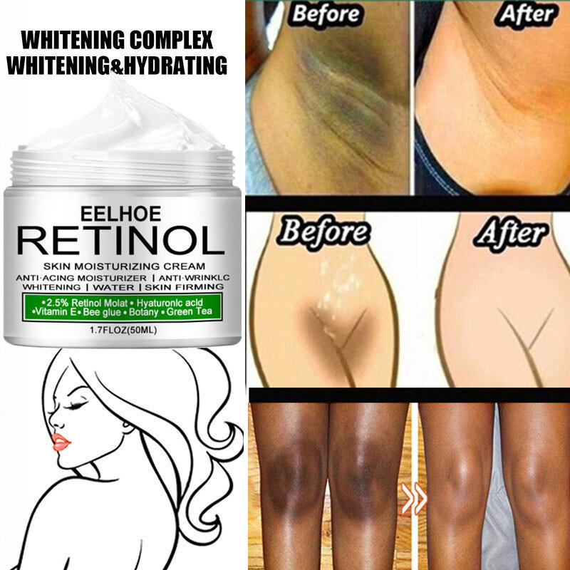 Private Parts Whitening Cream Underarm Bleaching Serum Whiten Butt Knee Brighten Inner Thigh  Intimate Parts Dark Remove Melanin