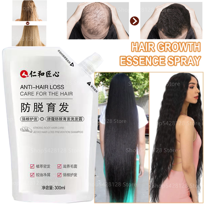 Champú a base de hierbas Anti-caída del cabello, champú de jengibre Anti-caída del cabello, crecimiento del cabello, desarrollo sólido, líquido para el cabello