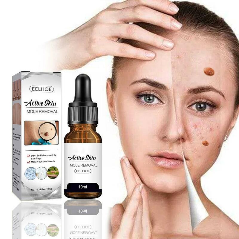 Solución para el cuidado corporal, esencia de lunares y verrugas, eliminación de cara y piel, limpieza de axilas, cuidado de carne, reparación de la piel del cuello