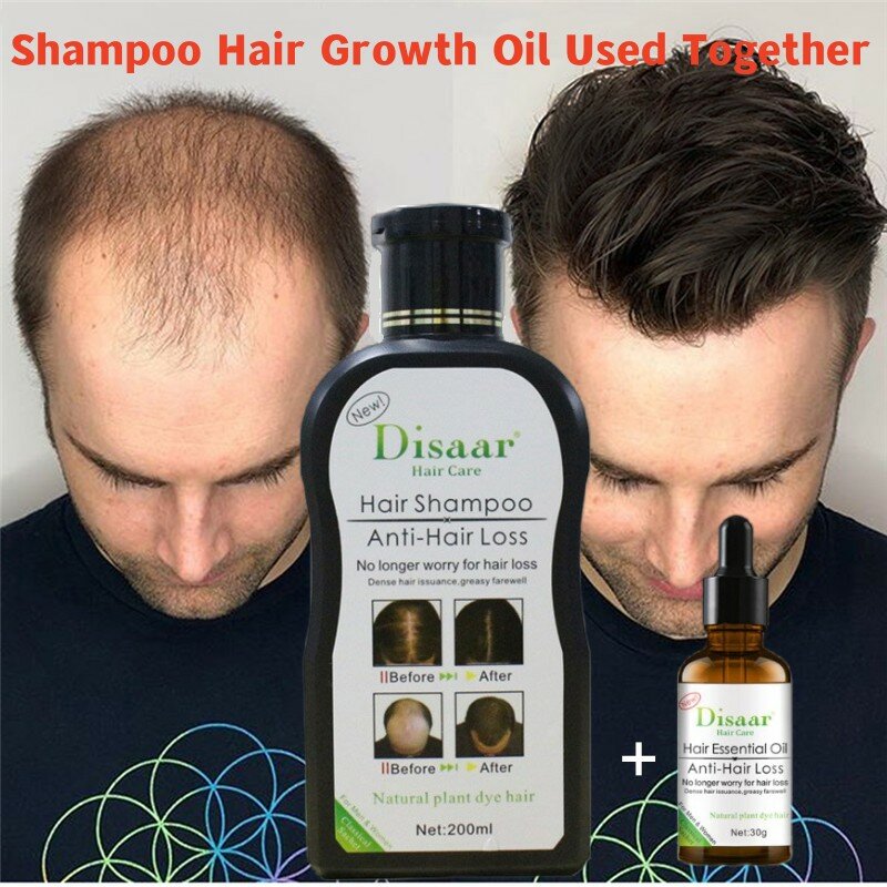 Shampooing naturel Anti-perte de cheveux, 200ml, sérum de traitement pour cheveux plus épais, tonique, nettoie le cuir chevelu, Essence de réparation des dommages