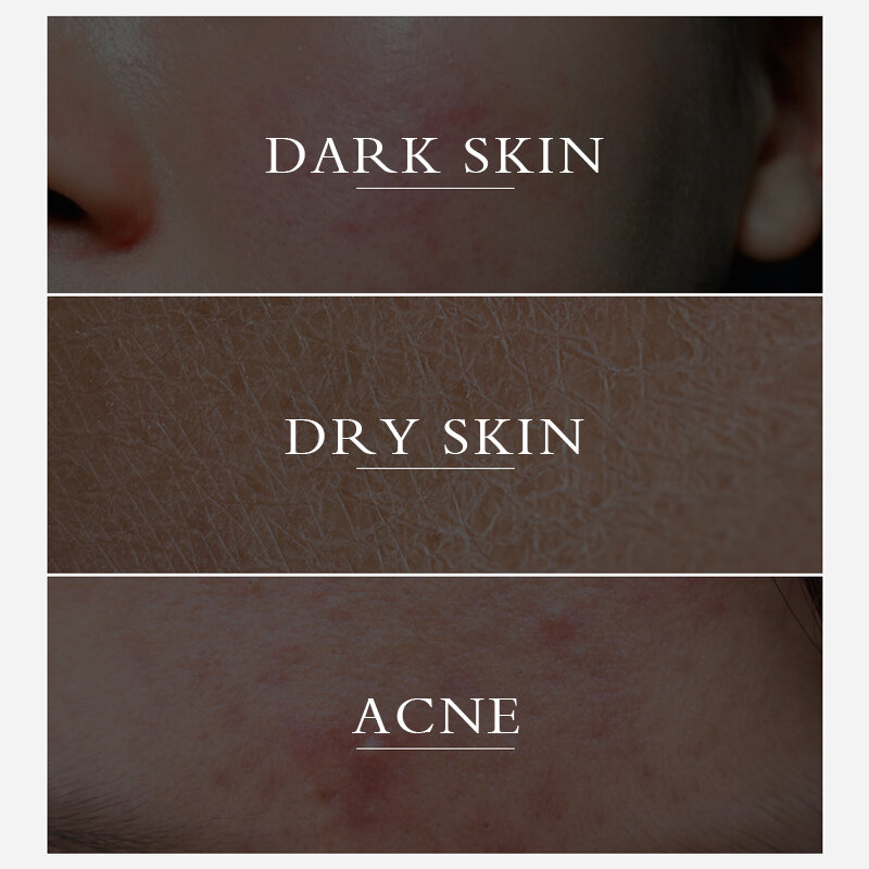 Lanthome-Crème pour le visage au curcuma, produit original, blanchissant, éclaircissant, organique, sérum pour la peau, anti-âge, SAP, pores, acné, hydratant