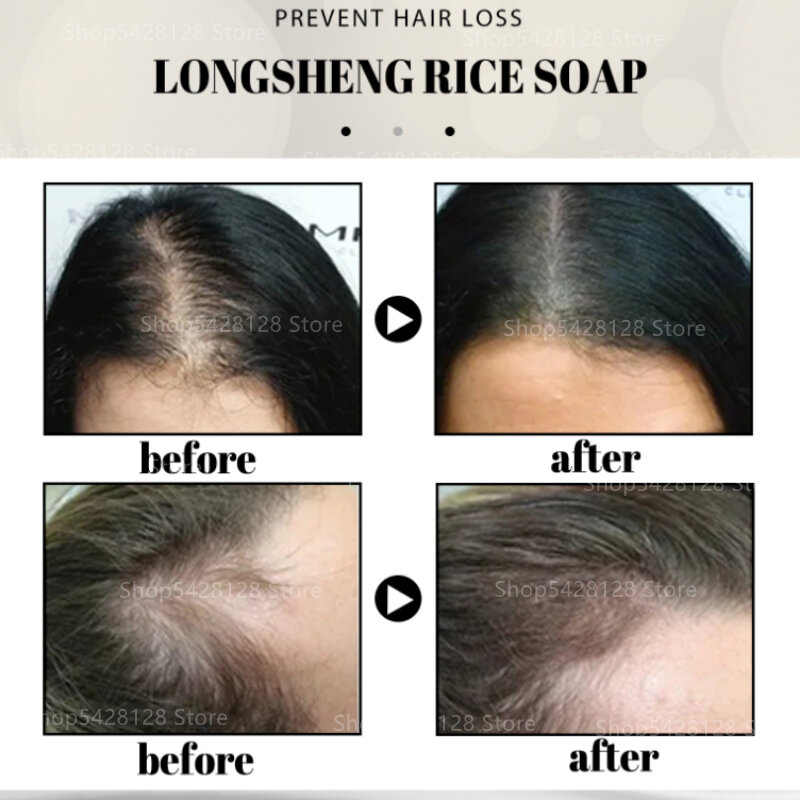 Pure Plant Extract Ginger Anti-hair Loss Shampoo Hair-increasing Dense Hair Liquid Anti-fall Shampoo Hair Growth Liquid 400ml