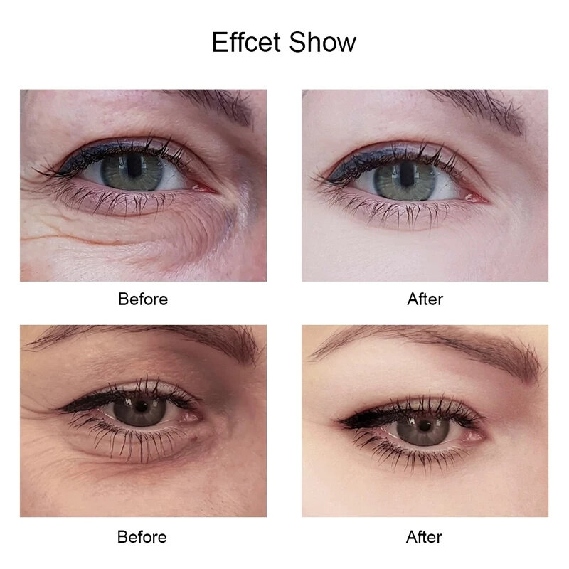 Gold Eye Essence ครีม Hyaluronic Acid Anti Puffiness Anti Wrinkle Remove Dark Circle Anti-Aging Caviar ครีมทาใต้ตา