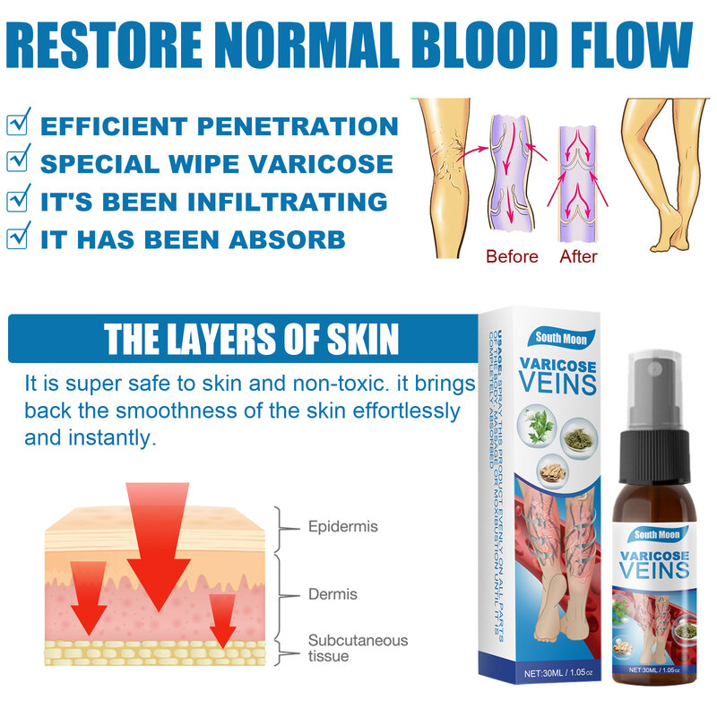 30ml Varicose Vein Massage Active Lotion Spray Vascular Bulge Leg Massage Spray Varicosity Angiitis Pain Relief Body Care Cream